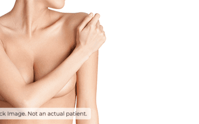 Which breast surgery suits you best?